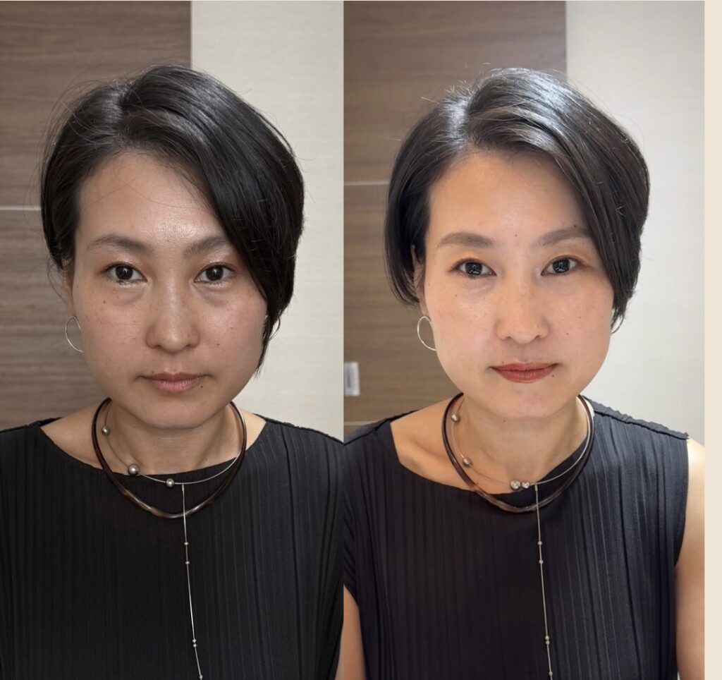Beige Minimalist Beauty Skincare Before After Collage Instagram Post 2 - Maison F 「変わりたい」と願うあなたへ。魅力開花するファッションアドバイス・メイクレッスン・美肌・講座が受けられるサロン。イメージコンサルタント | パーソナルカラー診断・骨格診断・顔タイプ診断・似合うメイクレッスン | 群馬県伊勢崎市 | メゾンF