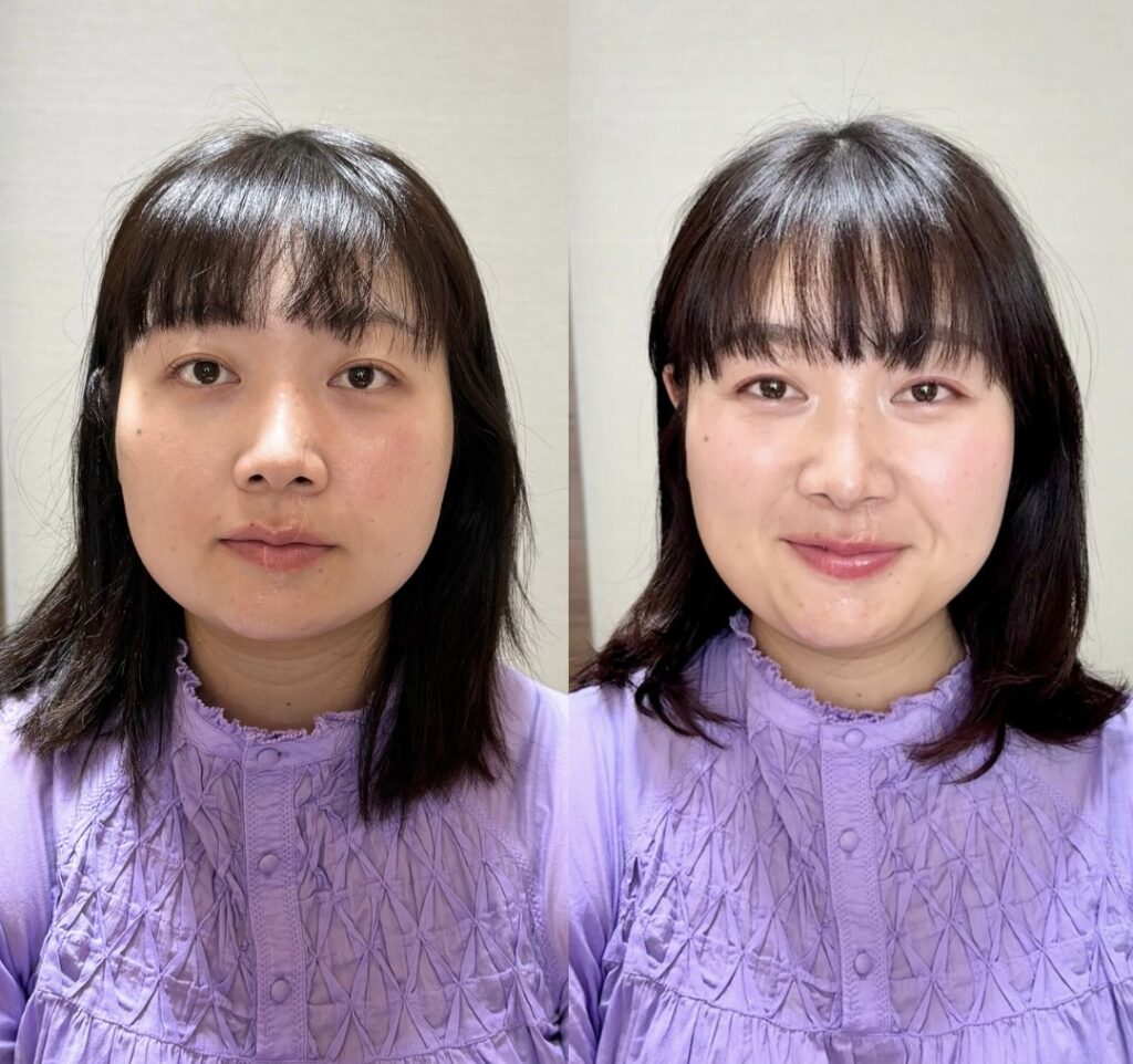 Beige Minimalist Beauty Skincare Before After Collage Instagram Post 3 - Maison F 「変わりたい」と願うあなたへ。魅力開花するファッションアドバイス・メイクレッスン・美肌・講座が受けられるサロン。イメージコンサルタント | パーソナルカラー診断・骨格診断・顔タイプ診断・似合うメイクレッスン | 群馬県伊勢崎市 | メゾンF